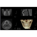     Rayscan α+ 3D 130x100 Ceph